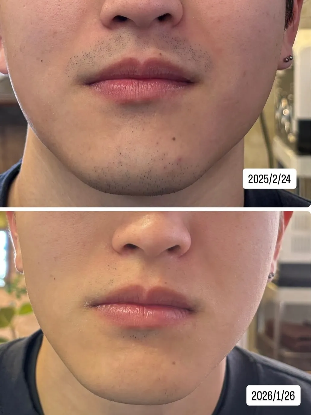 約1年後こうなりました‼️